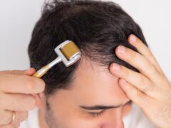 man with bald on head using oil spray, derma roller with needles for hair growth stimulation. guy using shampoo brush with silicone,flexible bristles, for scalp massage.isolated male with products