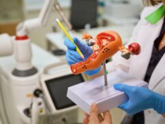 Gynecologist uses a mock-up of the uterus during a consultation