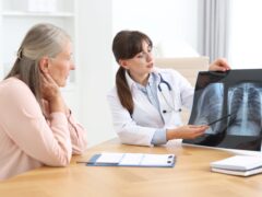 Lung disease. Doctor showing chest x-ray to her patient at table in clinic