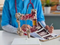 Doctor examines digestive system model and ultrasound image. Stomach intestine ulcers cyst and oncology and examination