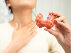 Hyperthyroidism, Overactive Thyroid, Thyroid Lymphoma, Asian woman with thyroid gland human anatomy model.