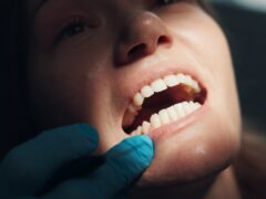 Oral cancer: symptoms everyone should know