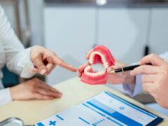 A doctor points to a teeth mold while explaining the importance of oral health.
